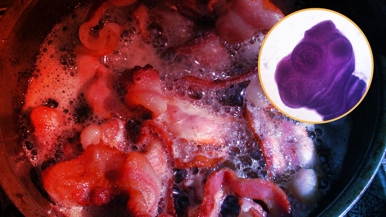 Tényleg el lehet kapni agyférget egy túl puha bacon miatt?