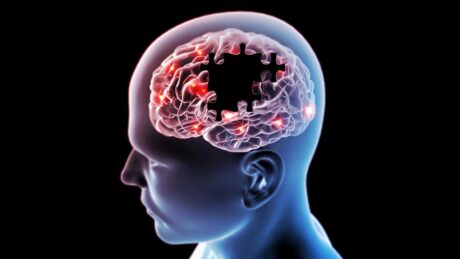 Az Alzheimer-kór egyik fehérjéje segíthet a rák legyőzésében
