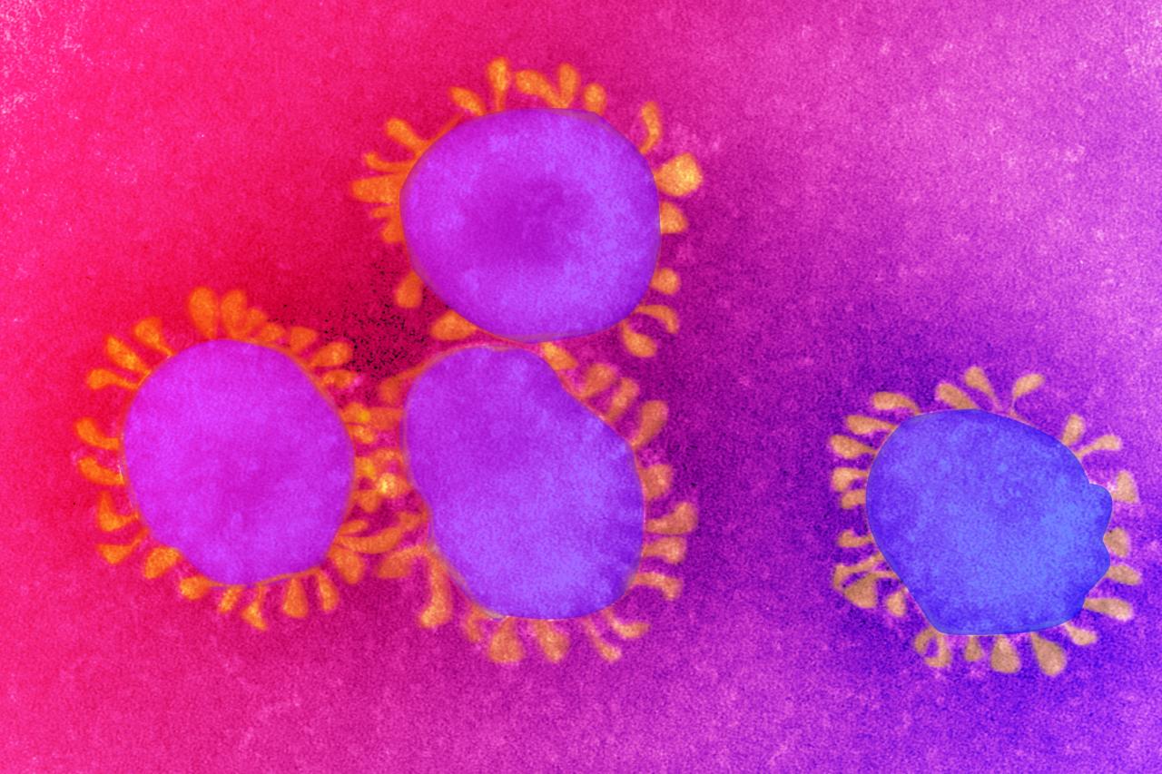 Az anyai COVID-fertőzés növelheti az autizmus kockázatát