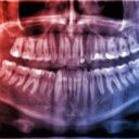 Miért nem számítanak a fogak csontnak, itt az igazság