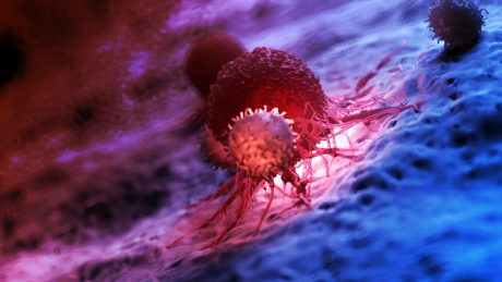 A statinok lehetnek az immunterápia kudarcának hiányzó láncszemei