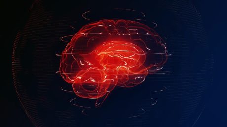 Az MI már másodpercek alatt kiértékeli az agyi MR-felvételeket