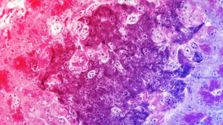 Az egérkísérlet, amely forradalmasíthatja a cukorbetegség kezelését