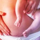 A császározás árnyoldala: nő a leukémia kockázata?