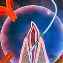 A fogselyem lehet a jövő oltótűje? Különös vakcinaforradalom