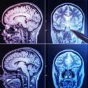 Az agy trükkjei: miért fáradunk el gondolkodás közben?