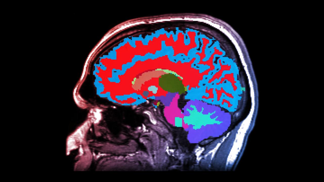 Az MRI, ami felfedi, ha gyorsabban öregszel