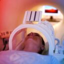 Az új öregedésmérő MRI-vizsgálattal jósolják meg a demenciát