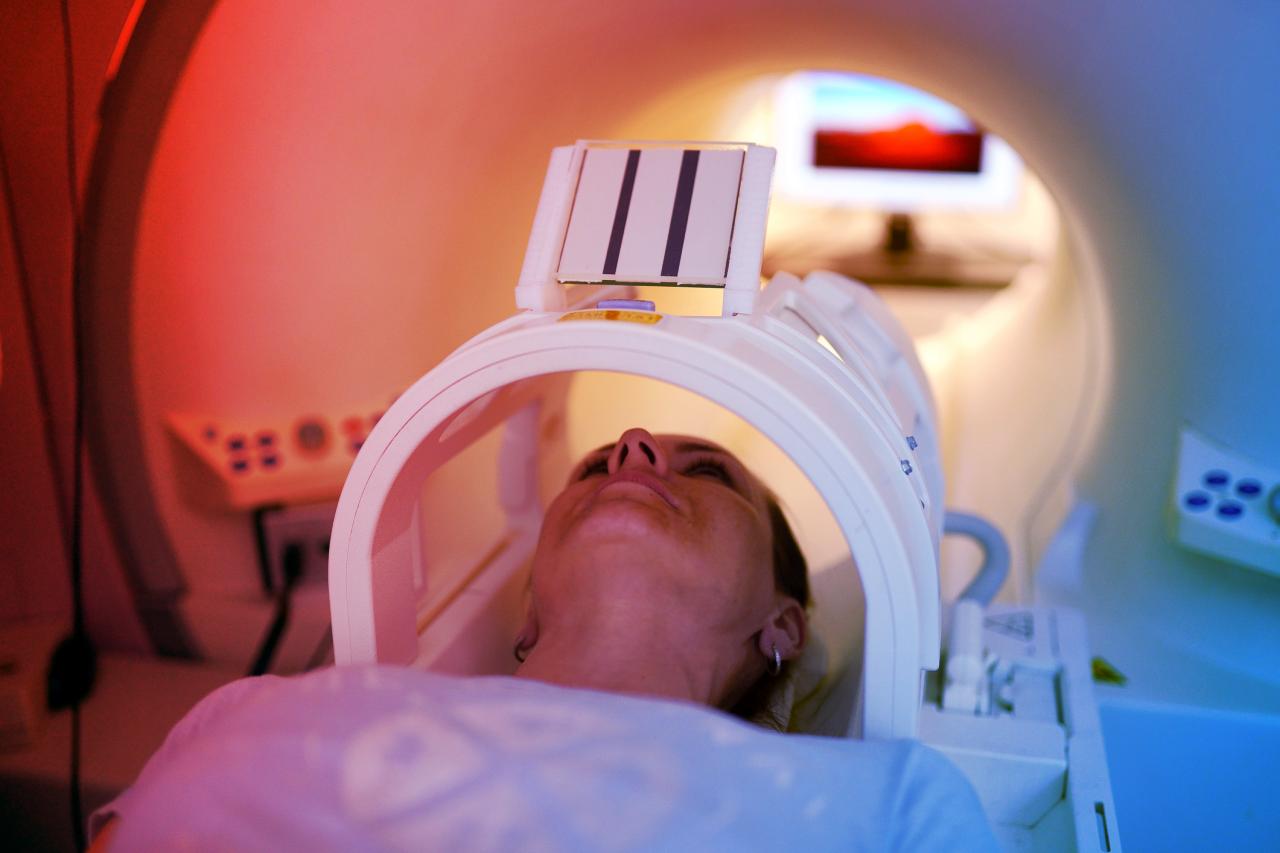 Az új öregedésmérő MRI-vizsgálattal jósolják meg a demenciát